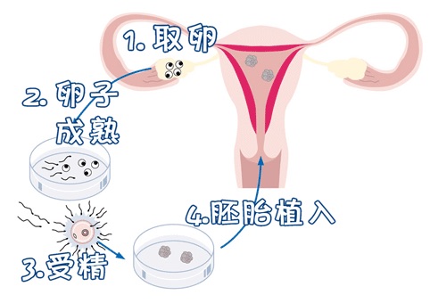 私人同性代怀助孕怎么收费